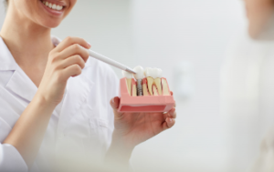 dental implant demonstration