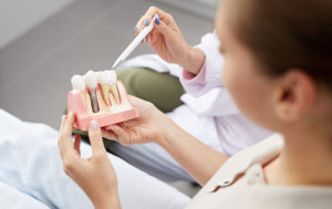 Dentist showing model of dental implant to patient