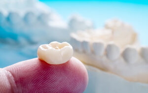 Dental crown sitting on a finger