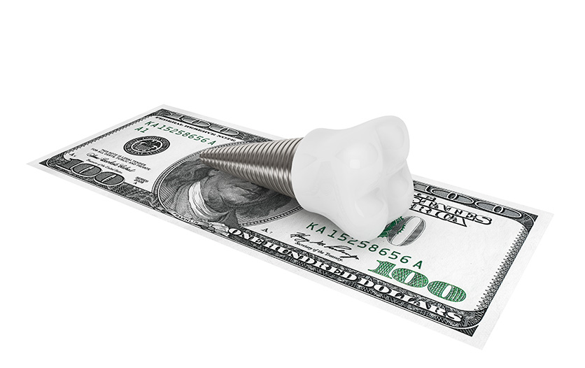 Implant tooth sitting on 100 dollar bill